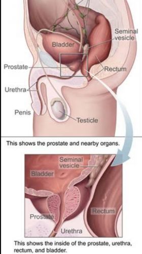 Prostate Diseases and Treatments 
